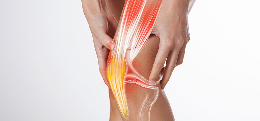 patient needing ligamentitis treatment in Dublin