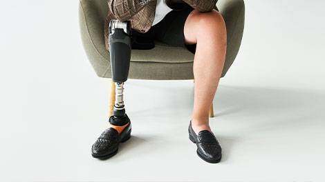 patient requiring phantom limb syndrome treatment in Dublin