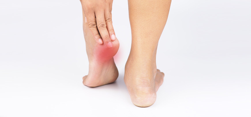 patient receiving plantar fasciitis care in Dublin