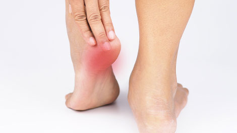 patient requiring plantar fasciitis treatment in Dublin